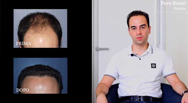 A tu per tu col chirurgo estetico